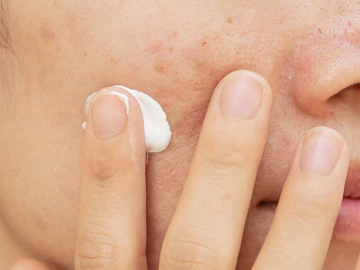 Best Anti Scar Dermatology Cream of 2023 in India 